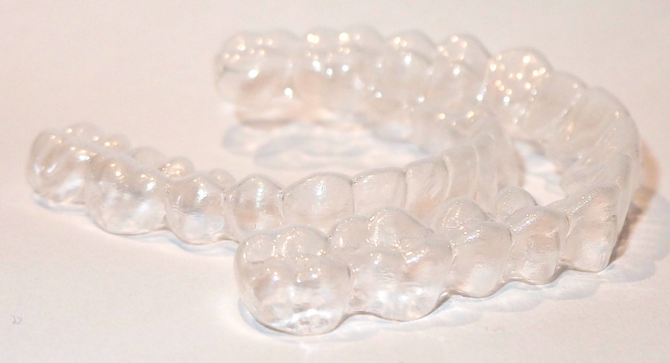 Invisalign Spark clear aligners to straighten kids teeth ...